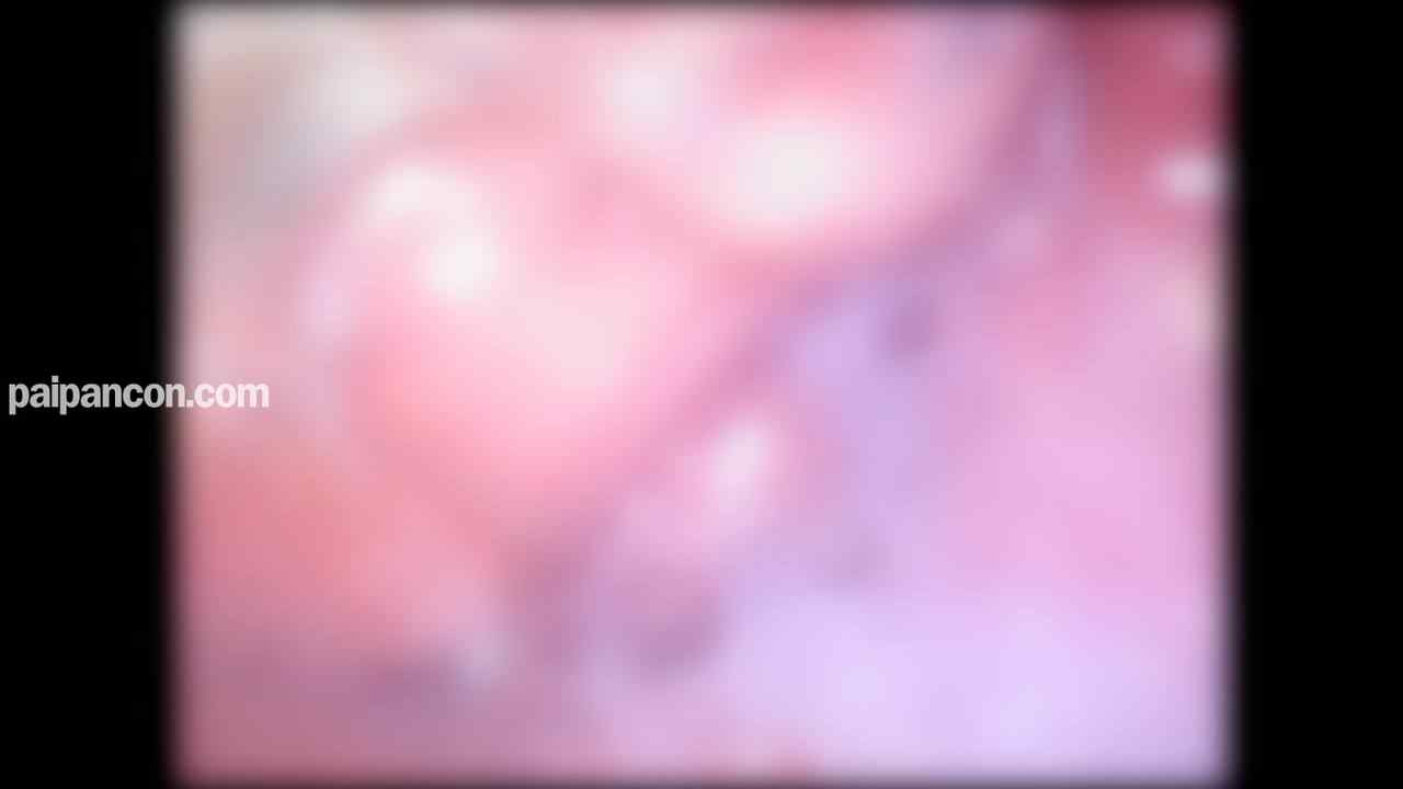 FC2-PPV-4815370 - ♀191 「あ”あ”気持ちいいぃぃ」感度抜群スレンダー美女が喘ぎまぐるウィンターナイト！中出し2回戦でたっぷりかるぴすを注入＆久しぶりの膣内カメラ　★特典で無修正と膣内カメラ thumbnail_9.jpg